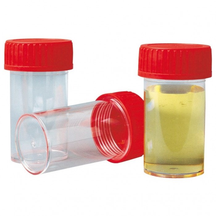 Diagnostic urinaire 