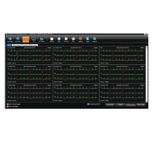 Logiciel SE-1515 - gestion de donnees patient pour ECG-EDAN
