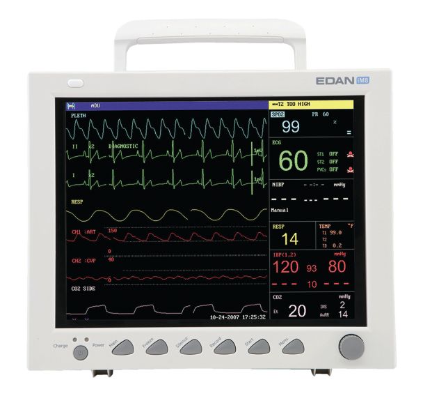 Moniteur de signe vitaux iM8-EDAN