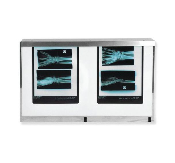 Négatoscope standard 2 plages 72 x 43 cm 108 W
