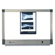 Négatoscope standard 2 plages 2 x 45W