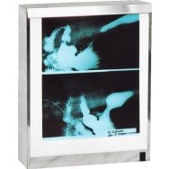 Le négatoscope standard 1 plage 60 x 43 cm 54 W